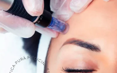 Descubre la Revolución en Belleza con Exosomas en Málaga